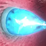 Il catetere smart a luce UV: interventi al cuore senza chirurgia