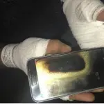 Galaxy S7 esplode nelle mani di un canadese