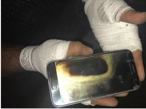 Galaxy S7 esplode nelle mani di un canadese